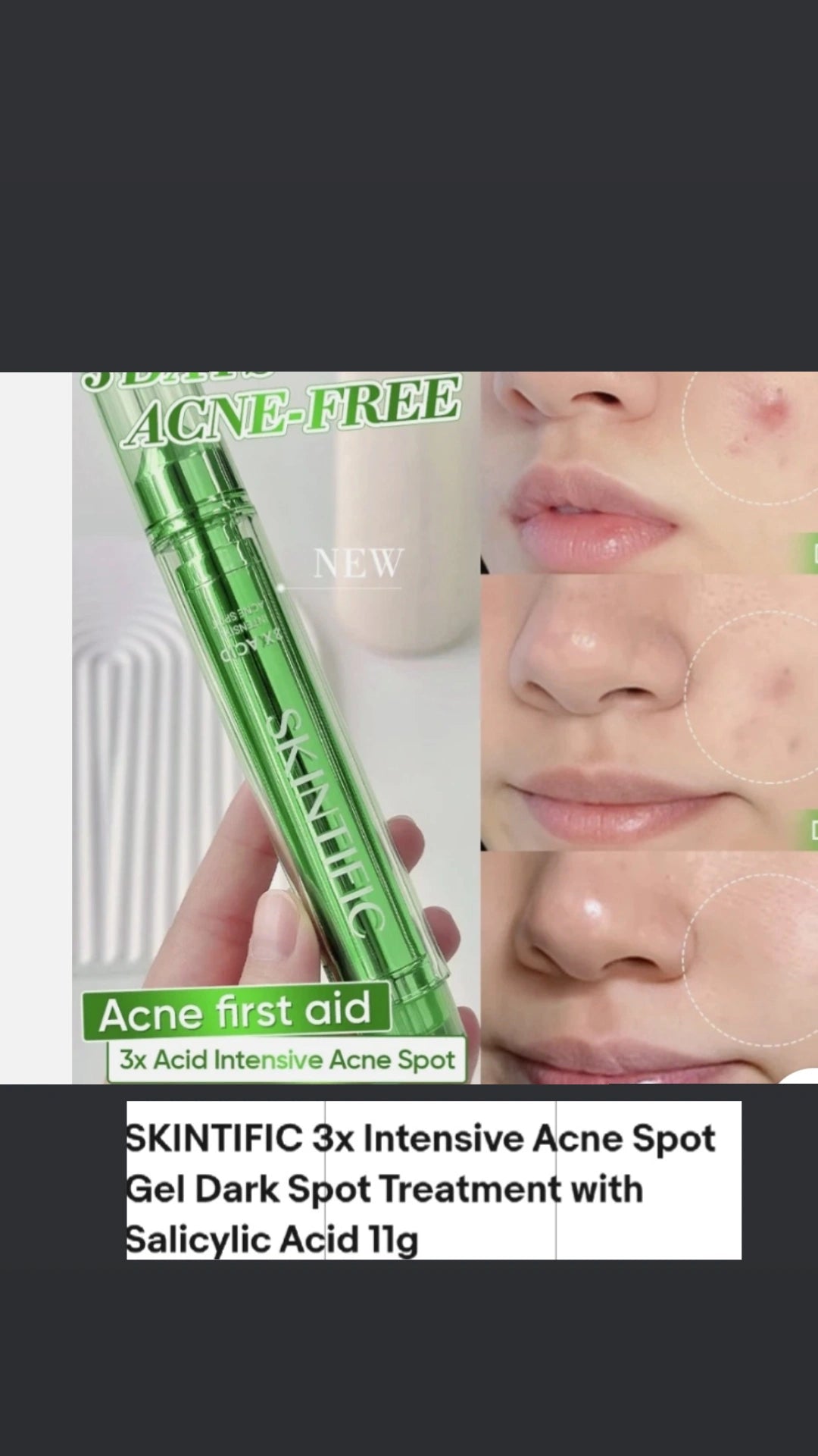Skintific 3X Acid Intensive Acne Spot