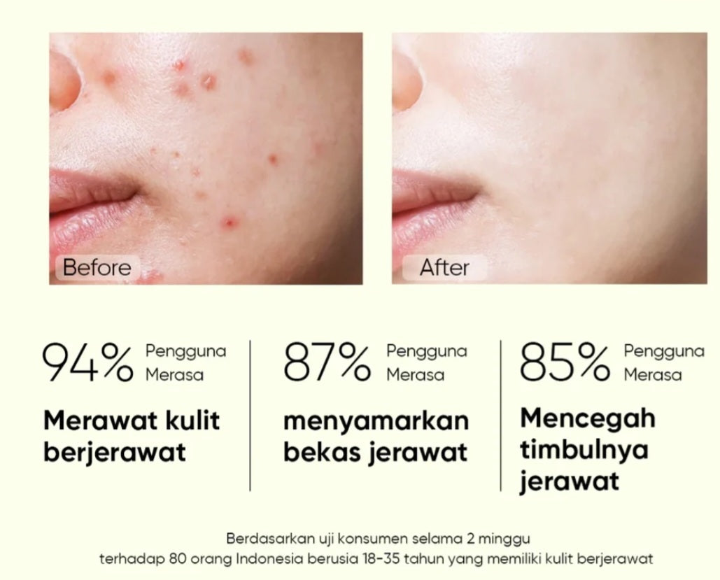 SKITIFIC 2% SALICYLIC ACID ANTI ACNE SERUM 20 ML