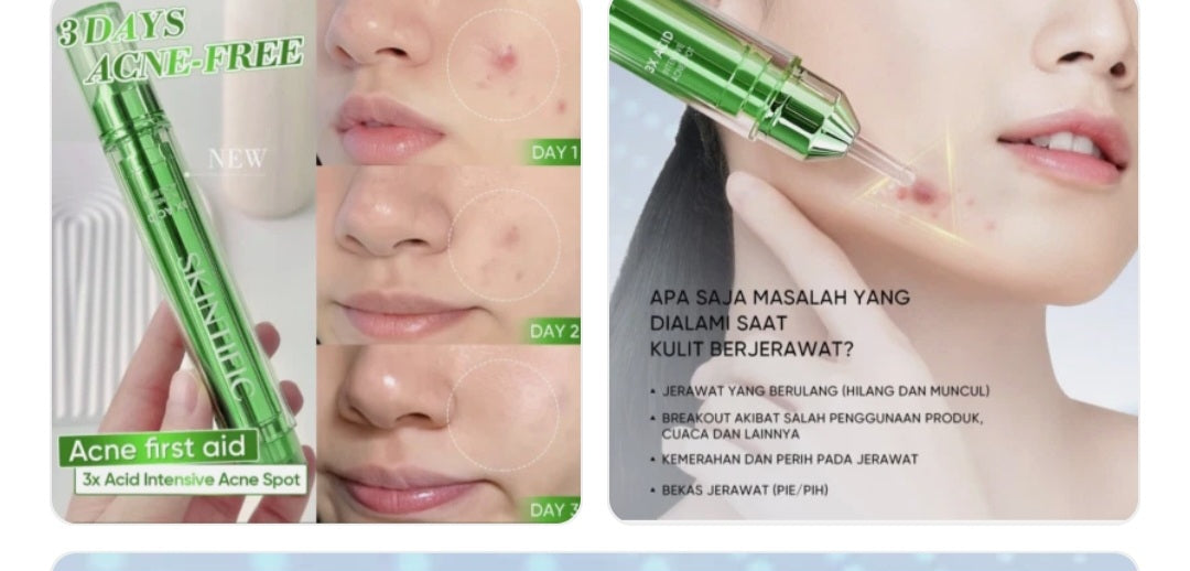 Skintific Anti Acne & smoothed skin 11 gm