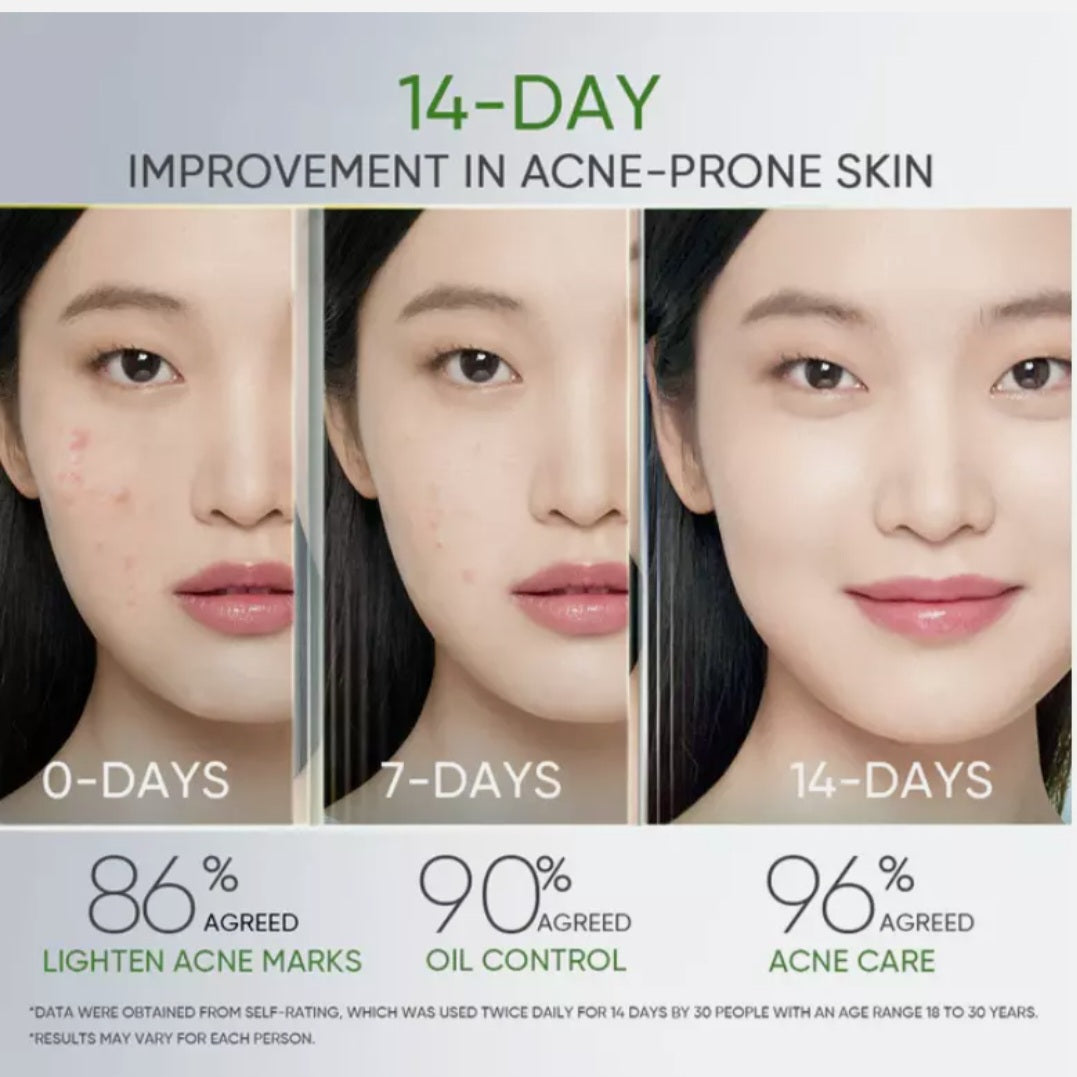 Skintific 3x Acid Anti Acne Gel moisturizer  30g