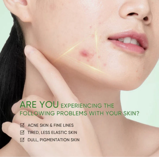 Skintific 3x Acid Acne Gel Cleanser