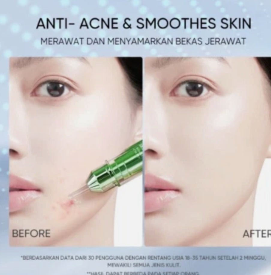 Skintific  Anti Acne & smoothed skin 11 gm