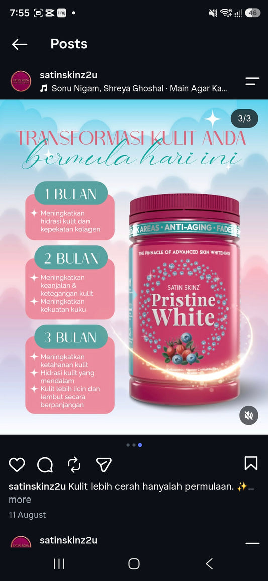 Setin skinz pristine White