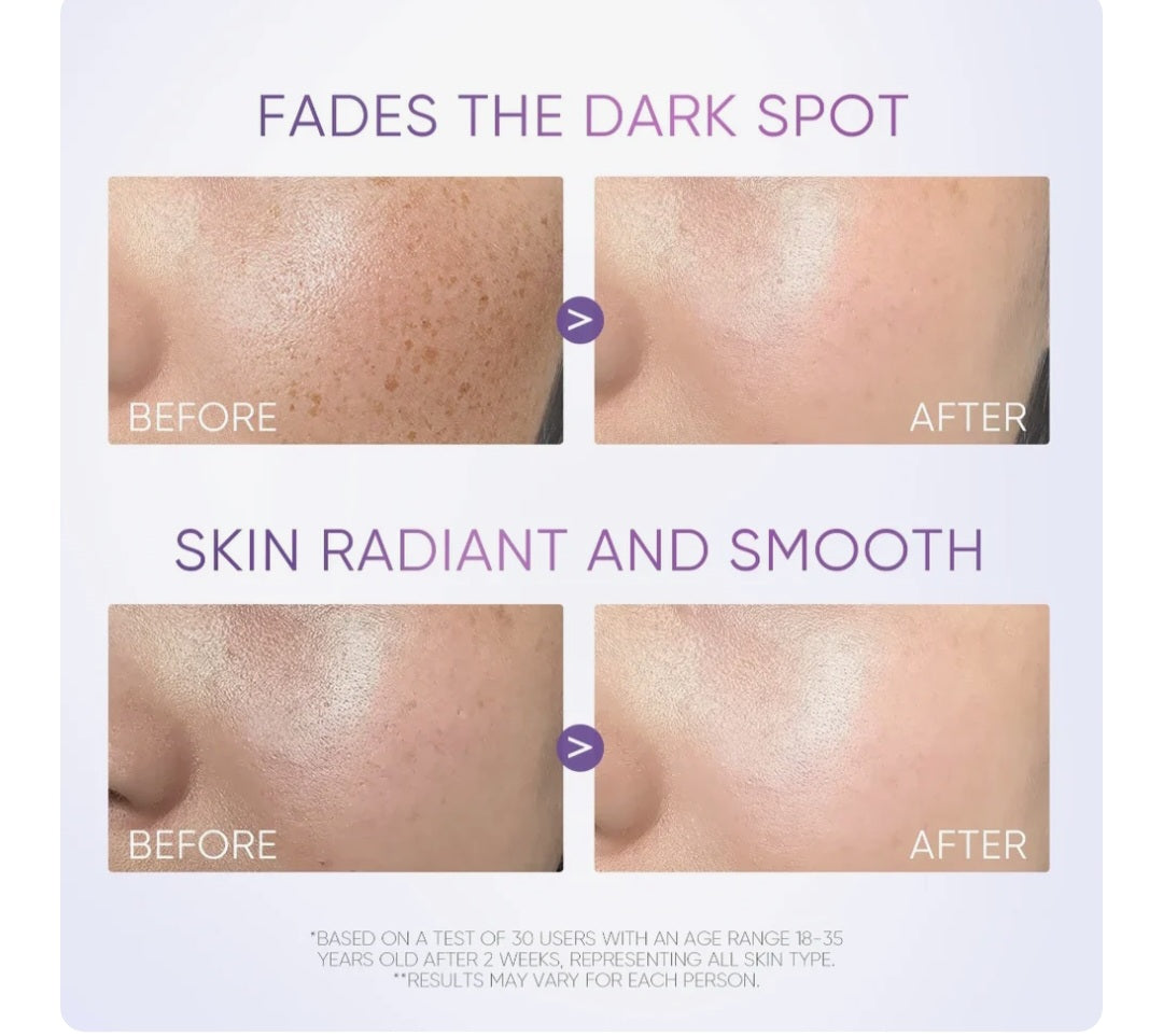 skintific  377 dark spot serum 20 ml